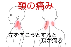 肩こり 首 肩 背中の痛み 頸肩腕症候群 横須賀市の鍼灸整体院 しん鍼灸院