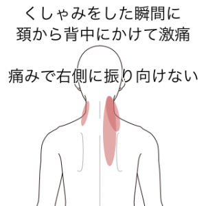 肩こり 首 肩 背中の痛み 頸肩腕症候群 横須賀市の鍼灸整体院 しん鍼灸院